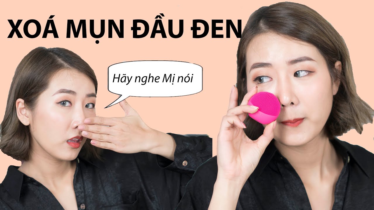 Bí quyết trị mụn đầu đen tại nhà cực hiệu quả 